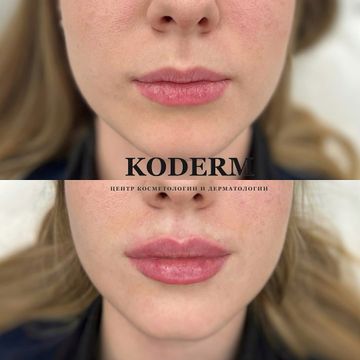 Photo of profile koderm.by - DFLBIuHtIql